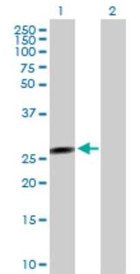 Western Blot: FLJ37201 Antibody [H00283011-B01P] - Analysis of FLJ37201 expression in transfected 293T cell line by FLJ37201 polyclonal antibody.  Lane 1: FLJ37201 transfected lysate(21.89 KDa). Lane 2: Non-transfected lysate.