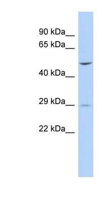 Western Blot: FLJ40504 Antibody [NBP1-56798] - MCF-7 whole cell lysates, concentration 0.2-1 ug/ml.