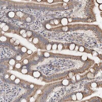 Immunohistochemistry-Paraffin: FLJ46536 Antibody [NBP1-91908] - Staining of human duodenum shows moderate cytoplasmic positivity in glandular cells.