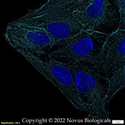 Immunocytochemistry/Immunofluorescence: FLNC Antibody [Alexa Fluor® 647] [NBP2-79816AF647] - U2OS cells were fixed in 4% paraformaldehyde for 10 minutes and permeabilized in 0.05% Triton X-100 in PBS for 5 minutes. The cells were incubated with FLNC Antibody conjugated to Alexa Fluor 647 (NBP2-79816AF647) at 5 ug/ml for 1 hour at room temperature. Nuclei were counterstained with DAPI (Blue). Cells were imaged using a 100X objective and digitally deconvolved.