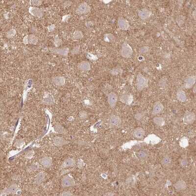 Immunohistochemistry: FLRT1 Antibody [NBP2-49139] - Staining of human hippocampus shows moderate positivity in neuropil.