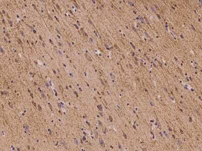 Immunohistochemistry-Paraffin: FLRT1 Antibody [NBP2-97173] - Immunochemical staining of human FLRT1 in human brain with rabbit polyclonal antibody at 1:100 dilution, formalin-fixed paraffin embedded sections.
