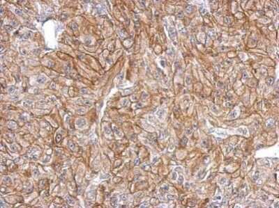 Immunohistochemistry-Paraffin: FLRT2 Antibody [NBP2-43653] - Mahlarvu xenograft, using FLRT2 antibody at 1:500 dilution. Antigen Retrieval: Trilogy™ (EDTA based, pH 8.0) buffer, 15min. 