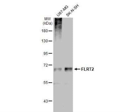 Western Blot: FLRT2 Antibody [NBP2-43653] - Various whole cell extracts (30 ug) were separated by 7.5% SDS-PAGE, and the membrane was blotted with FLRT2 antibody diluted at 1:1000. The HRP-conjugated anti-rabbit IgG antibody (NBP2-19301) was used to detect the primary antibody, and the signal was developed with Trident ECL plus-Enhanced.