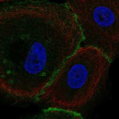Immunocytochemistry/Immunofluorescence: FLRT3 Antibody [NBP2-38778] - Staining of human cell line hTCEpi shows localization to plasma membrane & cell junctions. Antibody staining is shown in green.