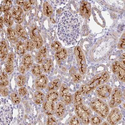 Immunohistochemistry-Paraffin: FLRT3 Antibody [NBP2-38778] - Staining of human kidney shows strong cytoplasmic and membranous positivity in cells in tubules.