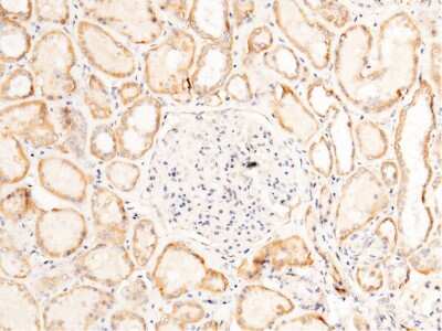 Immunohistochemistry-Paraffin: FLRT3 Antibody [NBP2-99728] - Immunochemical staining of human FLRT3 in human kidney with rabbit polyclonal antibody (1:1000, formalin-fixed paraffin embedded sections). Positive staining was localized to nephric tubule.