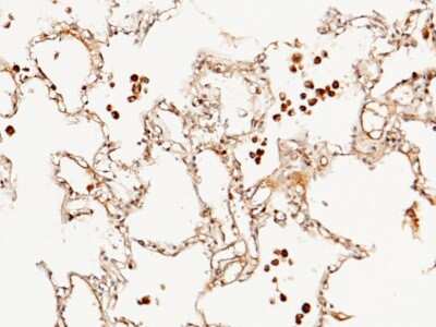 Immunohistochemistry-Paraffin: FLRT3 Antibody [NBP2-99728] - Immunochemical staining of human FLRT3 in human lung with rabbit polyclonal antibody (1:1000, formalin-fixed paraffin embedded sections).
