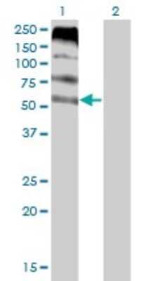 Western Blot: FLVCR Antibody (4B2) [H00028982-M05] - Analysis of FLVCR expression in transfected 293T cell line by FLVCR monoclonal antibody (M05), clone 4B2. Lane 1: FLVCR transfected lysatE (59.9 KDa). Lane 2: Non-transfected lysate.