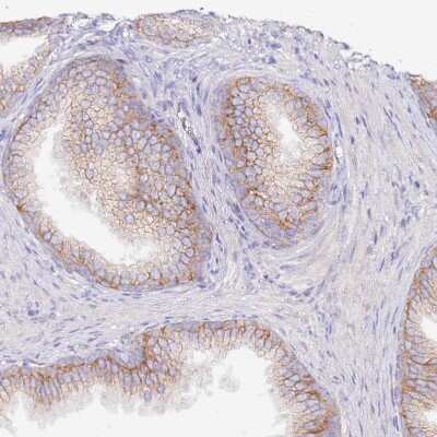 Immunohistochemistry-Paraffin: FLVCR Antibody [NBP2-14019] - Staining of human prostate shows moderate membranous positivity in glandular cells.