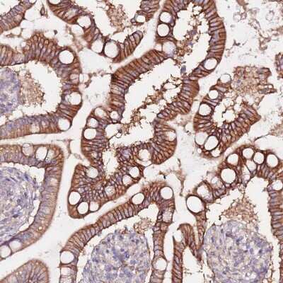 Immunohistochemistry-Paraffin: FLVCR Antibody [NBP2-14019] - Staining of human small intestine shows strong membranous positivity in glandular cells.