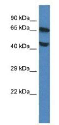 Western Blot: FLVCR Antibody [NBP1-91456] - Mouse Brain Lysate 1ug/ml  Gel Concentration 12%