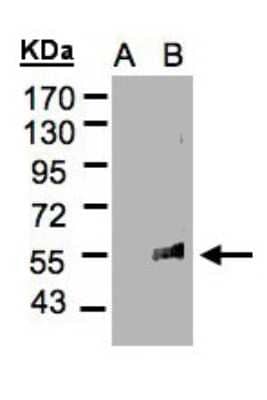 Western Blot: FLVCR Antibody [NBP2-16509] - Western Blot analysis of FLVCR1 expression in transfected 293T cell line by FLVCR1 polyclonal antibody. A: Non-transfected lysate. B: FLVCR1 transfected lysate. 7. 5% SDS PAGE gel, diluted at 1:500.