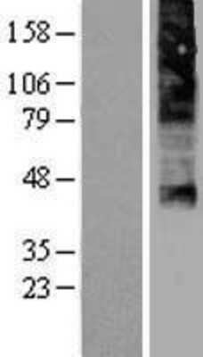 Western Blot: FLVCR Overexpression Lysate (Adult Normal) [NBP2-04342] Left-Empty vector transfected control cell lysate (HEK293 cell lysate); Right -Over-expression Lysate for FLVCR.