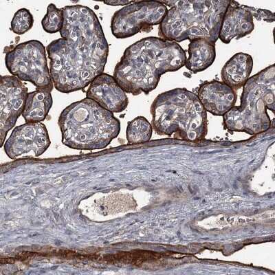 Immunohistochemistry-Paraffin: FLVCR2 Antibody [NBP1-94146] - Staining of human placenta shows strong membranous positivity in trophoblastic cells.