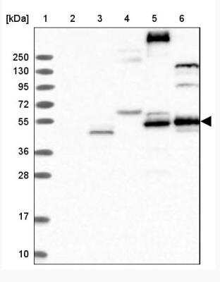 Western Blot: FLVCR2 Antibody [NBP1-94146] - Lane 1: Marker [kDa] 250, 130, 95, 72, 55, 36, 28, 17, 10 Lane 2: Human cell line RT-4 Lane 3: Human cell line U-251MG sp Lane 4: Human plasma (IgG/HSA depleted) Lane 5: Human liver tissue Lane 6: Human tonsil tissue