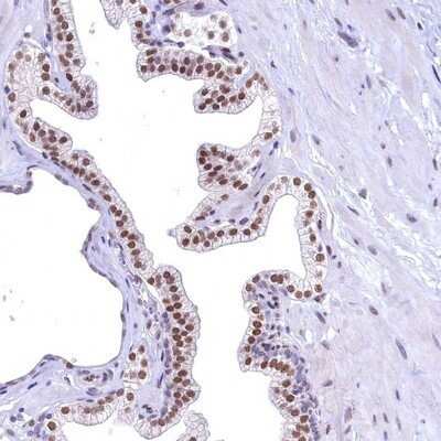 Immunohistochemistry-Paraffin: FLYWCH2 Antibody [NBP1-86227] - Staining of human prostate shows moderate nuclear positivity in glandular cells.