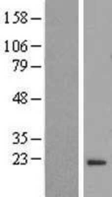 Western Blot: FLYWCH2 Overexpression Lysate (Adult Normal) [NBL1-10775] Left-Empty vector transfected control cell lysate (HEK293 cell lysate); Right -Over-expression Lysate for FLYWCH2.