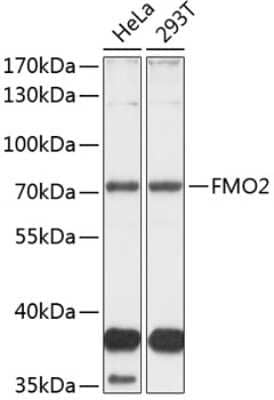 Western Blot: FMO2 Antibody [NBP3-04849] - Analysis of extracts of various cell lines, using FMO2 antibody at 1:1000 dilution. Secondary antibody: HRP Goat Anti-Rabbit IgG (H+L) at 1:10000 dilution. Lysates/proteins: 25ug per lane. Blocking buffer: 3% nonfat dry milk in TBST. Detection: ECL Basic Kit