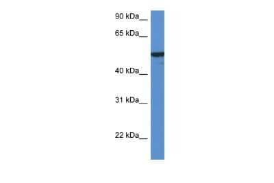 Western Blot: FMO2 Antibody [NBP2-87454] - WB Suggested Anti-FMO2 Antibody. Titration: 1.0 ug/ml. Positive Control: 293T Whole Cell