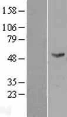 Western Blot: FMO2 Overexpression Lysate (Adult Normal) [NBL1-10776] Left-Empty vector transfected control cell lysate (HEK293 cell lysate); Right -Over-expression Lysate for FMO2.