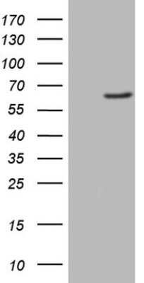 Western Blot: FMO3 Antibody (OTI3H1) - Azide and BSA Free [NBP2-70755] - Analysis of HEK293T cells were transfected with the pCMV6-ENTRY control (Left lane) or pCMV6-ENTRY FMO3 .