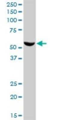 Western Blot: FMO3 Antibody [H00002328-B01P] - Analysis of FMO3 expression in human liver.