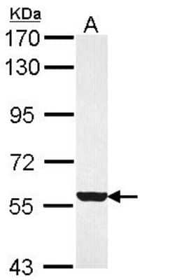 Western Blot: FMO3 Antibody [NBP1-33583] - Sample (30 ug of whole cell lysate) A: H1299 7. 5% SDS PAGE; antibody diluted at 1:1000.