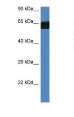 Western Blot: FMO3 Antibody [NBP1-82415] - Titration: 1.0 ug/ml Positive Control: Mouse Heart.