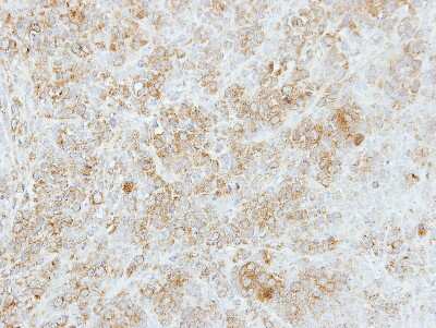 Immunohistochemistry-Paraffin: FMO5 Antibody [NBP2-16512] - 4T1 xenograft, using FMO5  antibody at 1:500 dilution. Antigen Retrieval: Trilogy™ (EDTA based, pH 8.0) buffer, 15min.