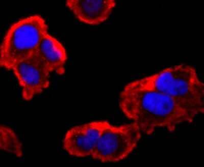 Immunocytochemistry/Immunofluorescence: FMRP Antibody (JM91-41) [NBP2-66848] - Staining FMRP in Hela cells (red). The nuclear counter stain is DAPI (blue). Cells were fixed in paraformaldehyde, permeabilised with 0.25% Triton X100/PBS.
