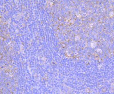 Immunohistochemistry-Paraffin: FMRP Antibody (JM91-41) [NBP2-66848] - Analysis of paraffin-embedded human tonsil tissue using anti-FMRP antibody. Counter stained with hematoxylin.