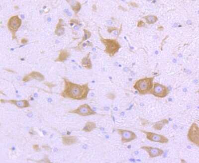 Immunohistochemistry-Paraffin: FMRP Antibody (JM91-41) [NBP2-66848] - Analysis of paraffin-embedded rat brain tissue using anti-FMRP antibody. Counter stained with hematoxylin.