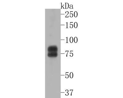 Western Blot: FMRP Antibody (JM91-41) [NBP2-66848] - Western blot analysis of FMRP on Daudi cell lysates. Proteins were transferred to a PVDF membrane and blocked with 5% BSA in PBS for 1 hour at room temperature. The primary antibody (1/500) was used in 5% BSA at room temperature for 2 hours. Goat Anti-Rabbit IgG - HRP Secondary Antibody (HA1001) at 1:5,000 dilution was used for 1 hour at room temperature.