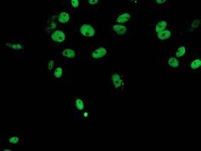 Immunocytochemistry/Immunofluorescence: FMRP Antibody (OTI1C6) - Azide and BSA Free [NBP2-70756] - Staining of COS7 cells transiently transfected by pCMV6-ENTRY FMRP.