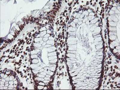 Immunohistochemistry: FMRP Antibody (OTI1C6) - Azide and BSA Free [NBP2-70756] - Staining of paraffin-embedded Human colon tissue using anti-FMRP mouse monoclonal antibody.