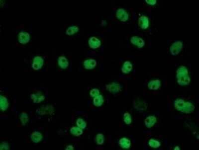 Immunocytochemistry/Immunofluorescence: FMRP Antibody (OTI3B4) - Azide and BSA Free [NBP2-70761] - Analysis of COS7 cells transiently transfected by pCMV6-ENTRY FMR1.