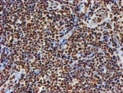 Immunohistochemistry: FMRP Antibody (OTI3B4) - Azide and BSA Free [NBP2-70761] - Analysis of Human lymphoma tissue.