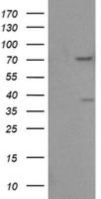 Western Blot: FMRP Antibody (OTI3B4) - Azide and BSA Free [NBP2-70761] - Analysis of HEK293T cells were transfected with the pCMV6-ENTRY control (Left lane) or pCMV6-ENTRY FMR1.