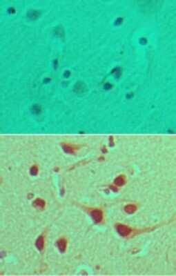 Immunohistochemistry-Paraffin: FNBP1 Antibody [NBP2-27082] - analysis of FNBP1 in formalin-fixed, paraffin-embedded human brain tissue using an isotype control (top) and this antibody (bottom) at 5 ug/ml.