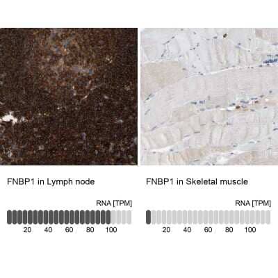 Immunohistochemistry-Paraffin: FNBP1 Antibody [NBP2-48542] - Staining in human lymph node and skeletal muscle tissues using anti-FNBP1 antibody. Corresponding FNBP1 RNA-seq data are presented for the same tissues.