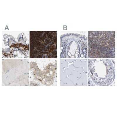 Immunohistochemistry-Paraffin: FNBP1 Antibody [NBP2-48542] - Staining of human colon, lymph node, skeletal muscle and testis using Anti-FNBP1 antibody NBP2-48542 (A) shows similar protein distribution across tissues to independent antibody NBP2-62603 (B).