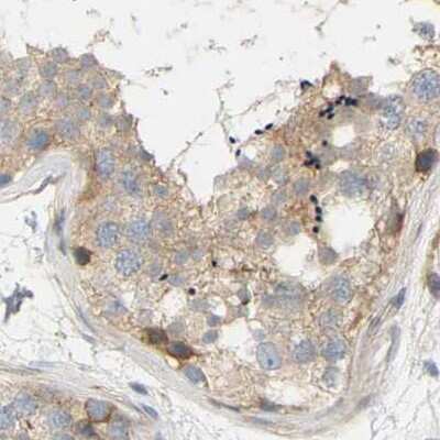 Immunohistochemistry-Paraffin: FNBP1 Antibody [NBP2-48542] - Staining of human testis.