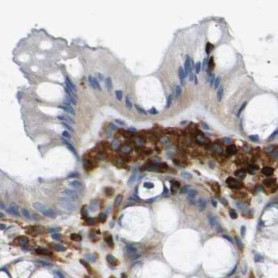 Immunohistochemistry-Paraffin: FNBP1 Antibody [NBP2-48542] - Staining of human colon.