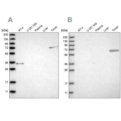 Western Blot: FNBP1 Antibody [NBP2-48542] - Analysis using Anti-FNBP1 antibody NBP2-48542 (A) shows similar pattern to independent antibody NBP2-48556 (B).