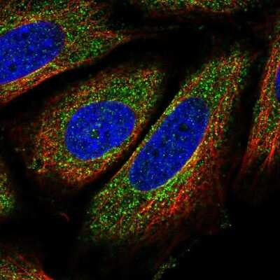 Immunocytochemistry/Immunofluorescence: FNBP1L Antibody [NBP2-49439] - Staining of human cell line SiHa shows localization to cytosol.