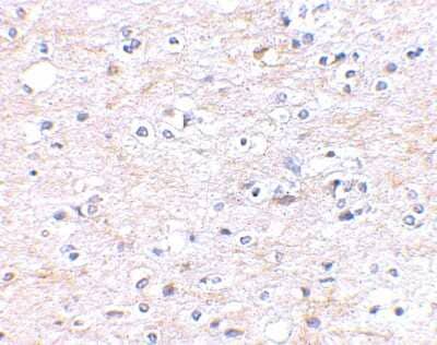 Immunohistochemistry-Paraffin: FNBP1L Antibody [NBP1-76846] - Human brain tissue using FNBP1L antibody at 2.5 ug/ml.