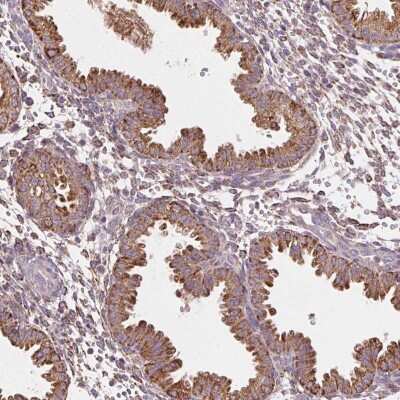 Immunohistochemistry-Paraffin: FNBP1L Antibody [NBP2-49439] - Staining of human uterus shows strong cytoplasmic positivity in glandular cells.