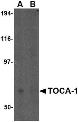 Western Blot: FNBP1L Antibody [NBP1-76846] - Human brain tissue lysate in (A) the absence and (B) the presence of blocking peptide with FNBP1L antibody at 0.5 ug/mL.