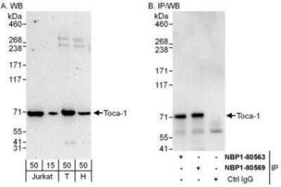 Western Blot: FNBP1L Antibody [NBP1-80569] - Whole cell lysate from Jurkat (15 and 50 mcg for WB; 1 mg for IP, 20% of IP loaded), 293T (T; 50 mcg) and HeLa (H; 50 mcg) cells.  Antibodies: Affinity purified rabbit anti-Toca-1 antibody  used for WB at 0.1 mcg/ml (A) and 1 mcg/ml (B) and used for IP at 6 mcg/mg lysate.  Toca-1 was also immunoprecipitated by rabbit anti-Toca-1 antibody NBP1-80563 which recognizes an upstream epitope.